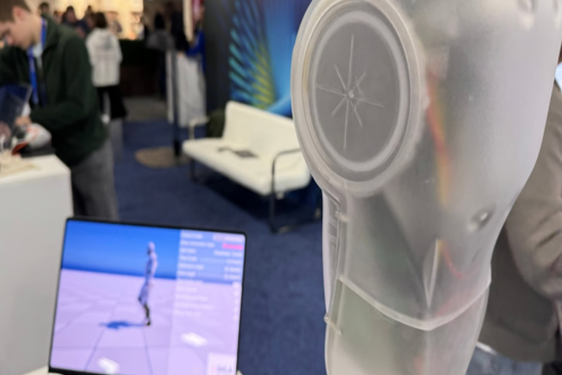 Ukrainian Innovators Combat War’s Impact with AI-Powered Bionic Knee 